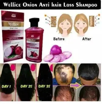 Onion hair repair shampoo